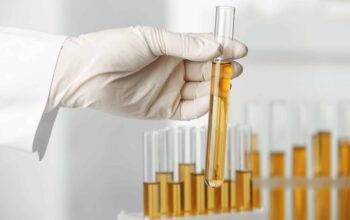 Drug Testing Services in Denver for Child Welfare Agencies: A Comprehensive Guide