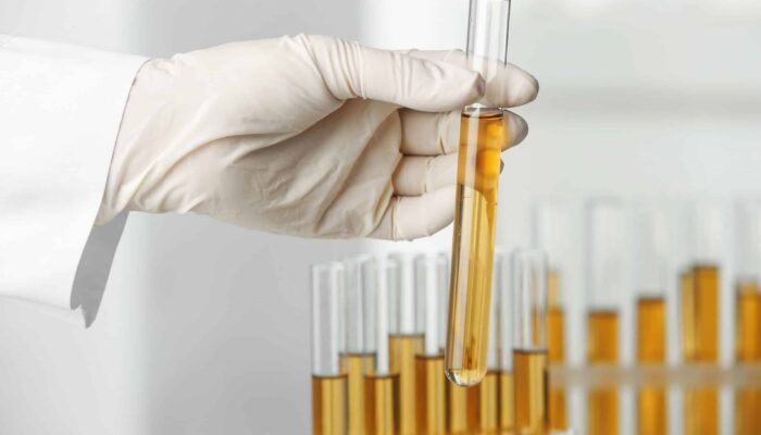 Drug Testing Services in Denver for Child Welfare Agencies: A Comprehensive Guide